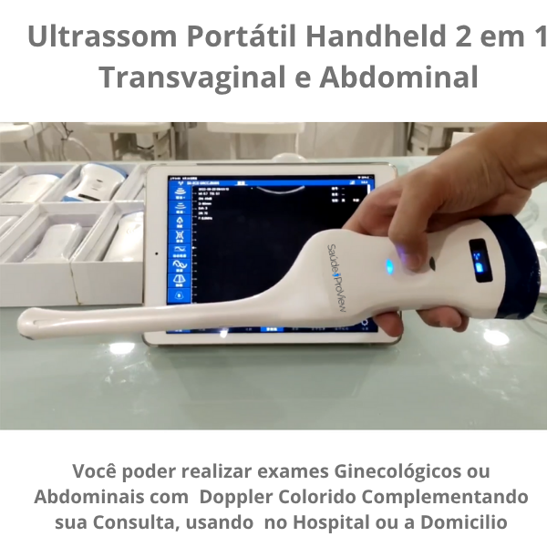 Ultrassom Portátil 2 em 1 , Dual Head, Phase Array, 128 Elementos, Multifuncional Transvaginal e Abdominal, WiFi, Handheld