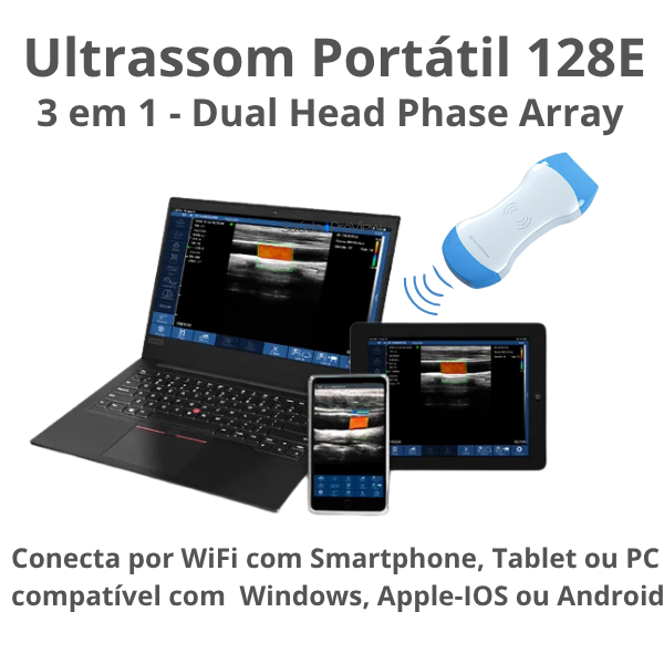 Ultrassom Portátil Inteligente Handheld, WiFi, 128 Elementos, Multifuncional 3 em 1 - 2025