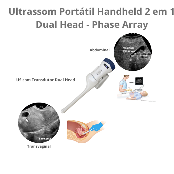 Ultrassom Portátil 2 em 1 , Dual Head, Phase Array, 128 Elementos, Multifuncional Transvaginal e Abdominal, WiFi, Handheld