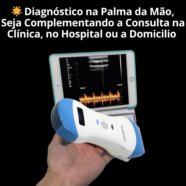 Ultrassom Portátil Inteligente Handheld, WiFi, 128 Elementos, Multifuncional 3 em 1 - 2025