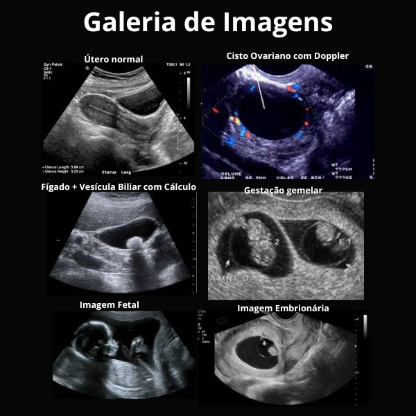 Ultrassom Portátil 2 em 1 , Dual Head, Phase Array, 128 Elementos, Multifuncional Transvaginal e Abdominal, WiFi, Handheld