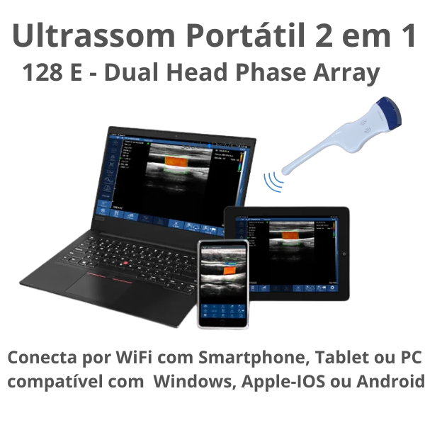 Ultrassom Portátil 2 em 1 , Dual Head, Phase Array, 128 Elementos, Multifuncional Transvaginal e Abdominal, WiFi, Handheld