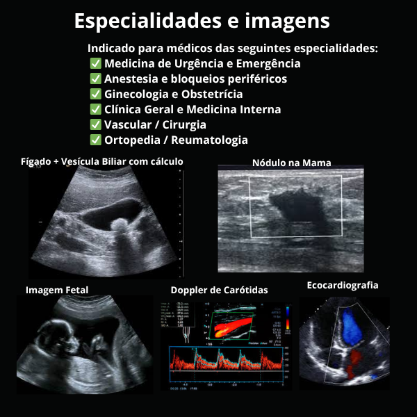Ultrassom Portátil Inteligente Handheld, WiFi, 128 Elementos, Multifuncional 3 em 1 - 2025