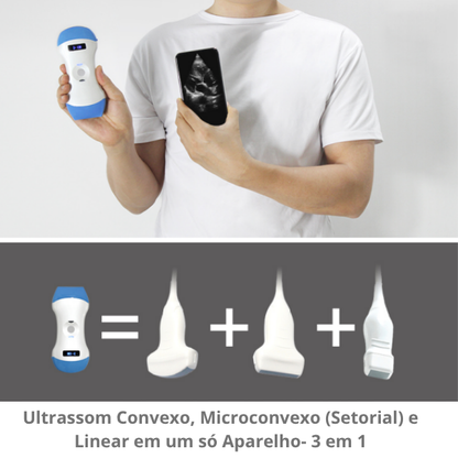 Ultrassom Portátil Veterinário  SaúdeProView Handheld, WiFi, 128E 3 em 1
