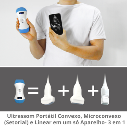 Ultrassom Portátil Veterinário  SaúdeProView Handheld, WiFi, 128E 3 em 1